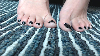 Black toenails closeup toe play