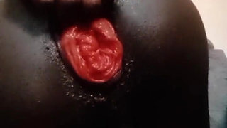 Fisting Black Ass and Prolapse