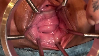 Exploring My Cervix With Sound And Fingers