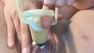 Cervix Pump in Black Stockings Another Angle