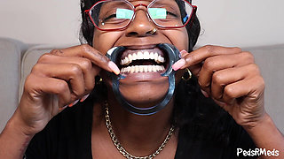 Youronlyphoenix Dental Retractor Mouth Tour