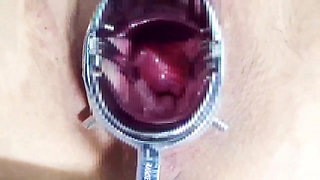 Using a Speculum to Spread an M-woman's Pussy, Anal Training　1/2